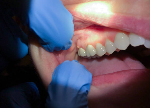 Best Emergency Treatment for Jaw Pain or Injury in Excelsior Springs, MO